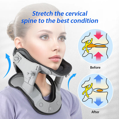 ThermoLift™ Cervical Traction Collar